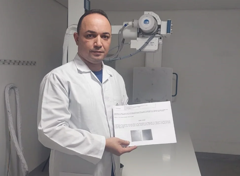 Açúcar causa danos a equipamento de Raio X da UPA