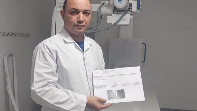 Açúcar causa danos a equipamento de Raio X da UPA